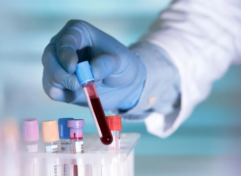 迪諾學院-IVD大講堂I第二課《試劑項目大分類》