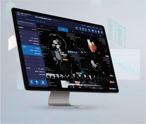 數(shù)坤科技 冠心病智能輔助診斷系統(tǒng)